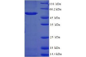 Aldo-keto Reductase Family 1, Member C2 (AKR1C2) (AA 1-323), (full length) protein (His-SUMO Tag)