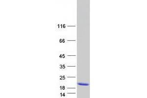 Western Blotting (WB) image for Mature T-Cell Proliferation 1 (MTCP1) protein (Myc-DYKDDDDK Tag) (ABIN2725558)