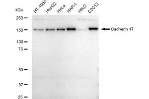 Western blotting analysis using Cadherin 17 antibody (ABIN7799264).