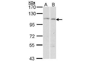 WB Image Sample (30 ug of whole cell lysate) A: Hela B: Molt-4 , 7. (GANAB 抗体  (C-Term))