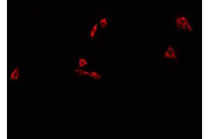 ABIN6273452 staining A549 cells by IF/ICC. (CD63 抗体  (Internal Region))