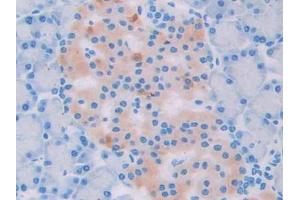 DAB staining on IHC-P; Samples: Rat Pancreas Tissue (UCP2 抗体  (AA 99-216))