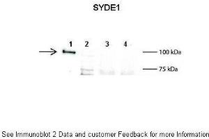 Lanes:   1: 2ug mouse SYDE1 transfected HEK293T lysate, 2: 15ug untransfected HEK293T lysate, 3: 100ug wild type mouse brain lysate, 4: 100ug SYDE1 knock-out mouse brain lysate  Primary Antibody Dilution:   1:500  Secondary Antibody:   Anti-rabbit L-chain HRP  Secondary Antibody Dilution:   1:10,000  Gene Name:   SYDE1  Submitted by:   Anonymous (SYDE1 抗体  (N-Term))