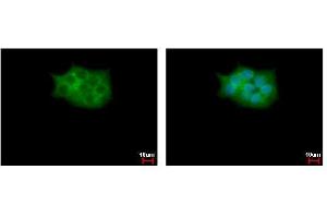 ICC/IF Image SCAP2 antibody [C2C3], C-term detects SKAP2 protein at cytoplasm by immunofluorescent analysis. (SKAP2 抗体  (C-Term))