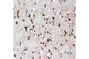 Anti- p73 antibody, IHC(P) IHC(P): Rat Brain Tissue (Tumor Protein p73 抗体  (AA 1-198))