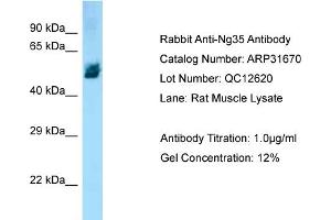 WB Suggested Anti-Ng35 Antibody   Titration: 1. (ZBTB12 抗体  (Middle Region))