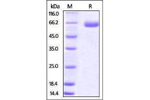 Mouse B7-H3, Fc Tag on SDS-PAGE under reducing (R) condition. (CD276 Protein (CD276) (AA 29-244) (Fc Tag))