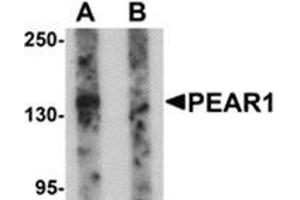 Western blot analysis of PEAR1 in rat kidney tissue lysate with PEAR1 antibody at 1 μg/ml in (A) the absence and (B) the presence of blocking peptide. (PEAR1 抗体  (C-Term))
