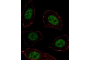 Fluorescent image of U251 cell stained with MSX1 Antibody .