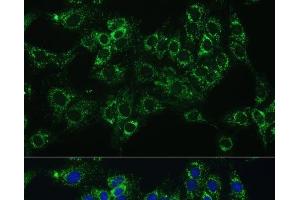 Immunofluorescence analysis of C6 cells using CYB5A Polyclonal Antibody at dilution of 1:100 (40x lens). (CYB5A 抗体)