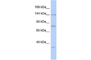 WB Suggested Anti-RNASEN Antibody Titration:  0. (DROSHA 抗体  (Middle Region))