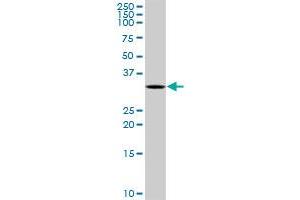 SNRPA MaxPab rabbit polyclonal antibody. (SNRPA1 抗体  (AA 1-282))