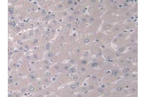 IHC-P analysis of Human Liver Tissue, with DAB staining. (IGFBP4 抗体  (AA 22-258))