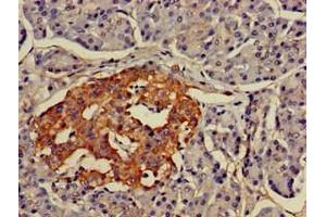 Immunohistochemistry of paraffin-embedded human pancreatic tissue using ABIN7158379 at dilution of 1:100 (LMX1A 抗体  (AA 9-86))