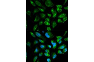 Immunofluorescence analysis of HepG2 cell using KIR2DL3 antibody. (KIR2DL3 抗体)