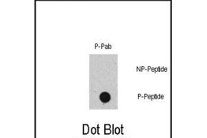 Dot blot analysis of Phospho-RAF1- polyclonal antibody (ABIN389732 and ABIN2839672) on nitrocellulose membrane. (RAF1 抗体  (pSer471))