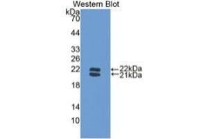 WB of Protein Standard: different control antibodies against Highly purified E. (Haptoglobin ELISA 试剂盒)
