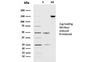 SDS-PAGE (SDS) image for anti-Programmed Cell Death 1 Ligand 2 (PDCD1LG2) (AA 27-220) antibody (ABIN6940946)