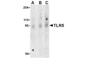 Image no. 1 for anti-Toll-Like Receptor 5 (TLR5) (Middle Region) antibody (ABIN265143) (TLR5 抗体  (Middle Region))