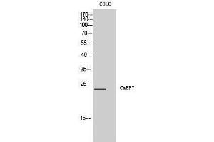 Western Blotting (WB) image for anti-Calcium Binding Protein 7 (CABP7) (N-Term) antibody (ABIN3174122) (CABP7 抗体  (N-Term))