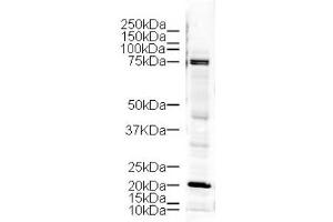 Image no. 1 for anti-LIM Domain Kinase 1 (LIMK1) (AA 630-647) antibody (ABIN401293) (LIM Domain Kinase 1 抗体  (AA 630-647))