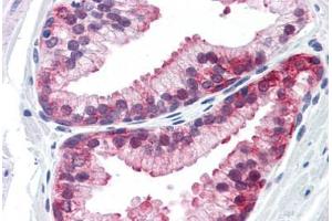 Human Prostate: Formalin-Fixed, Paraffin-Embedded (FFPE) (PAX2A 抗体  (AA 194-304))