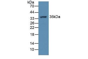 Figure. (ATP6AP2 抗体  (AA 18-302))