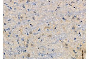 ABIN6266129 and ABIN6272494 at 1/100 staining Rat brain tissue by IHC-P. (ZNF462 抗体)