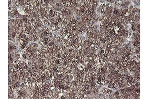 Image no. 4 for anti-Aminoacylase 1 (ACY1) antibody (ABIN1496455)