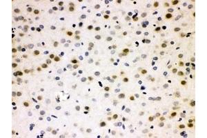 IHC testing of FFPE rat brain with CDC25B antibody. (CDC25B 抗体  (AA 119-248))