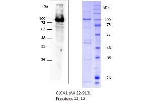 Image no. 1 for Chloride Channel Accessory 1 (CLCA1) (AA 22-913) protein (rho-1D4 tag,His tag) (ABIN3154921) (CLCA1 Protein (AA 22-913) (rho-1D4 tag,His tag))