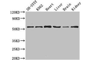 Western Blot Positive WB detected in: SH-SY5Y whole cell lysate, K562 whole cell lysate, Mouse heart tissue, Mouse liver tissue, Mouse brain tissue, Mouse kidney tissue All lanes: SLC16A9 antibody at 3.
