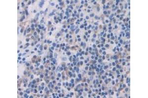Immunohistochemistry (IHC) image for anti-Zinc Finger, AN1-Type Domain 6 (ZFAND6) (AA 19-208) antibody (ABIN1860972)