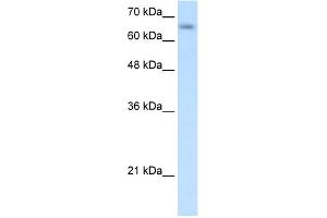WB Suggested Anti-SLC39A12 Antibody Titration:  0. (SLC39A12 抗体  (N-Term))