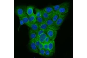 IF analysis of TUBGCP2 using anti-TUBGCP2 antibody (ABIN7600646).