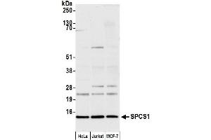 anti-Signal Peptidase Complex Subunit 1 (SPCS1) (AA 52-102) antibody