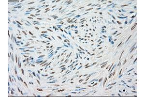 Immunohistochemical staining of paraffin-embedded Kidney tissue using anti-STK3mouse monoclonal antibody. (STK3 抗体)