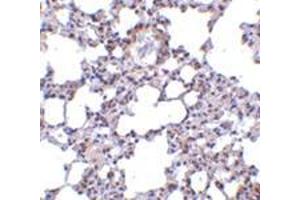 Immunohistochemistry of TRPC6 in mouse lung tissue with this product at 10 μg/ml.