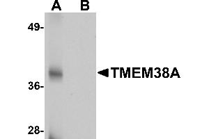 Western blot analysis of TMEM38A in rat skeletal muscle tissue lysate with TMEM38A antibody at 1 µg/mL in (A) the absence and (B) the presence of blocking peptide. (TMEM38A 抗体  (C-Term))