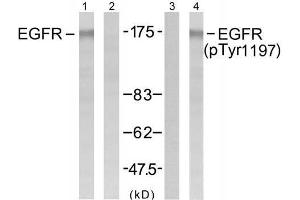 Western blot analysis of extract from A431 cells untreated or treated with EGF (200ng/ml, 5min), using EGFR (Ab-1197) antibody (E021221, Lane1 and 2) and EGFR (phospho-Tyr1197) antibody (E011228, Lane 3 and 4). (EGFR 抗体)
