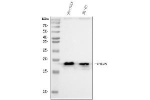 Western blot analysis of HMGN2 using anti-HMGN2 antibody (ABIN6719576).
