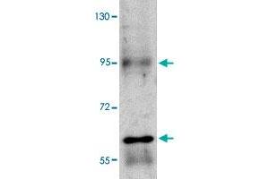 Western blot analysis of RUSC1 in A-20 cell lysate with RUSC1 polyclonal antibody  at 1 ug/mL . (RUSC1 抗体  (C-Term))