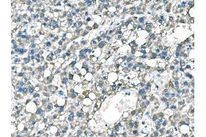 IHC analysis of B Raf/BRAF using anti-B Raf/BRAF antibody (ABIN3043761). (BRAF 抗体  (AA 38-230))