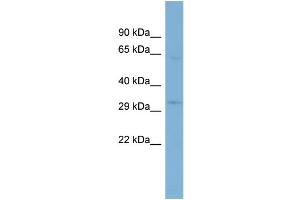 WB Suggested Anti-TMEM110  Antibody Titration: 0. (TMEM110 抗体  (N-Term))