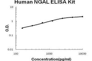 Human Lipocalin-2/NGAL PicoKine ELISA Kit standard curve (Lipocalin 2 ELISA 试剂盒)