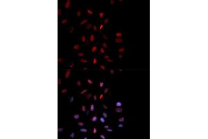 Immunofluorescence analysis of MCF7 cell using Phospho-FOS-T232 antibody. (c-FOS 抗体  (pThr232))