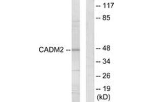 Western blot analysis of extracts from HepG2 cells, using CADM2 Antibody. (CADM2 抗体  (AA 131-180))