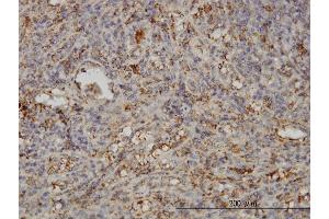 Immunoperoxidase of monoclonal antibody to SNAP23 on formalin-fixed paraffin-embedded human spleen. (SNAP23 抗体  (AA 1-211))