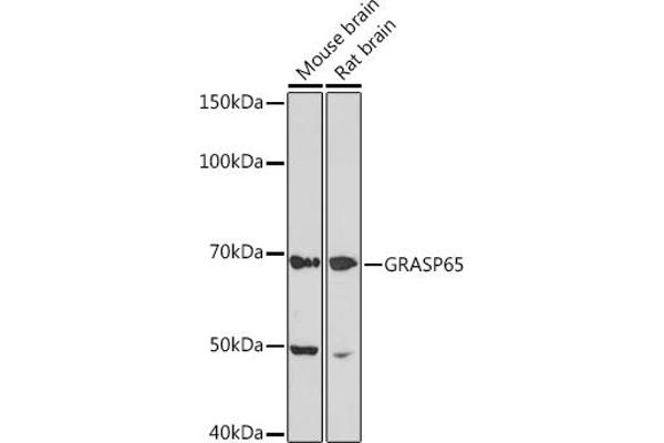 GORASP1 抗体