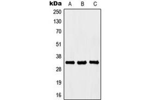 Western blot analysis of HOXB4 expression in Jurkat (A), K562 (B), PC12 (C) whole cell lysates. (HOXB4 抗体  (Center))